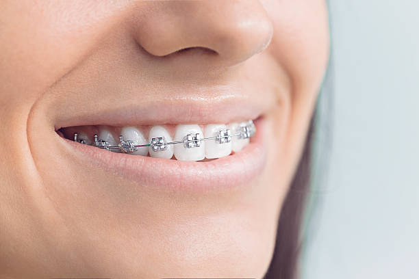 Best Invisalign and Clear Aligners  in Carthage, IL